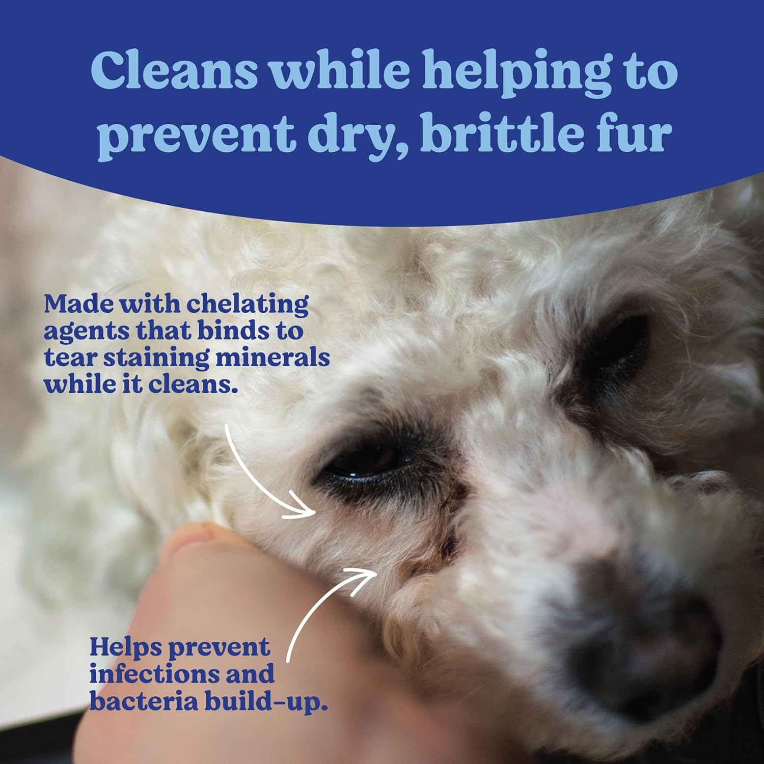 Angel's Eyes Gentle Tear Stain Wipes for Dogs and Cats - 100 Ct - Presoaked Textured (AEGTSW100) - Happypetzone.online - Image 2